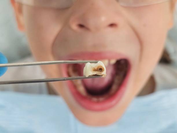 Best Emergency Root Canal Treatment in Foster Brook, PA